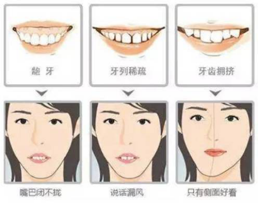 18岁矫正牙齿不想拔牙用什么—18岁矫正牙齿不想拔牙用什么牙膏(图1)